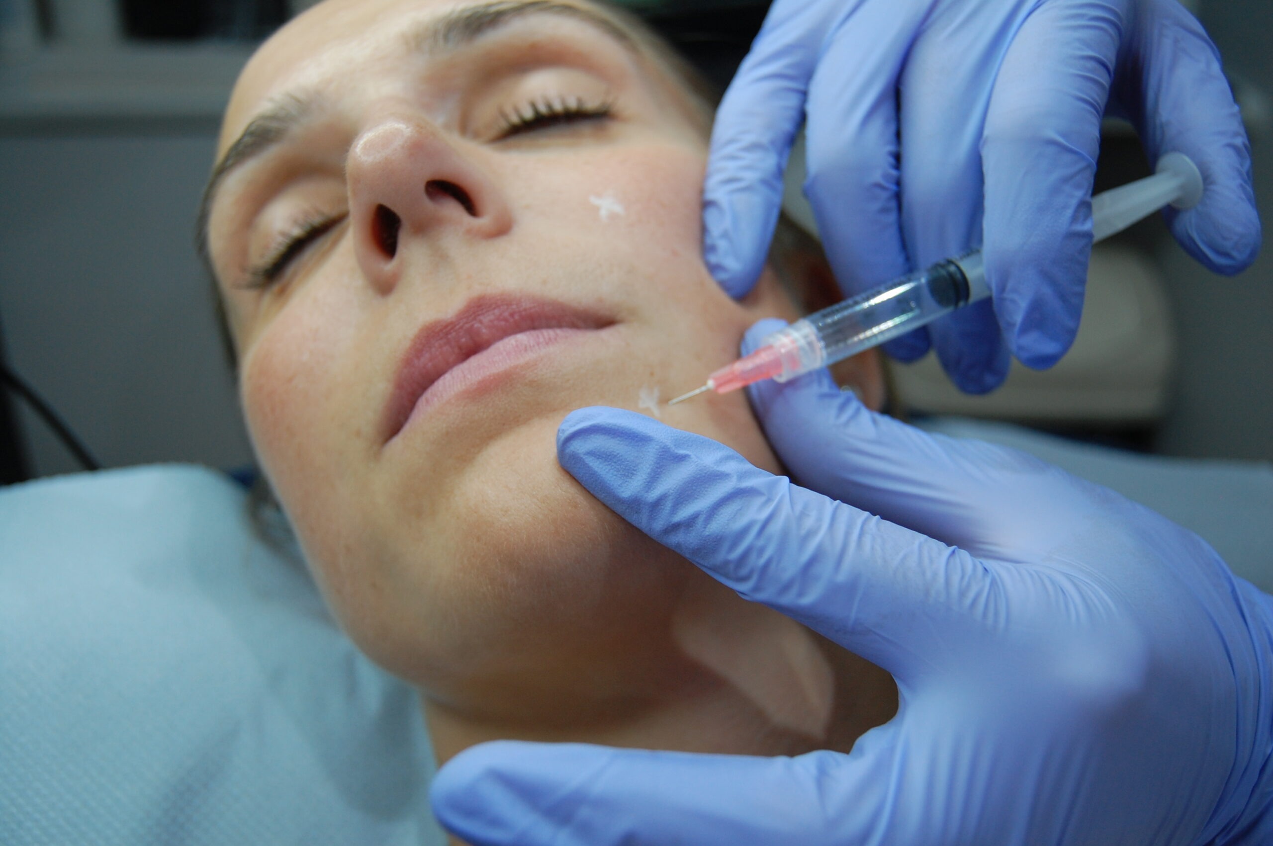 Treatment with Profhilo in Wandsworth SW18
