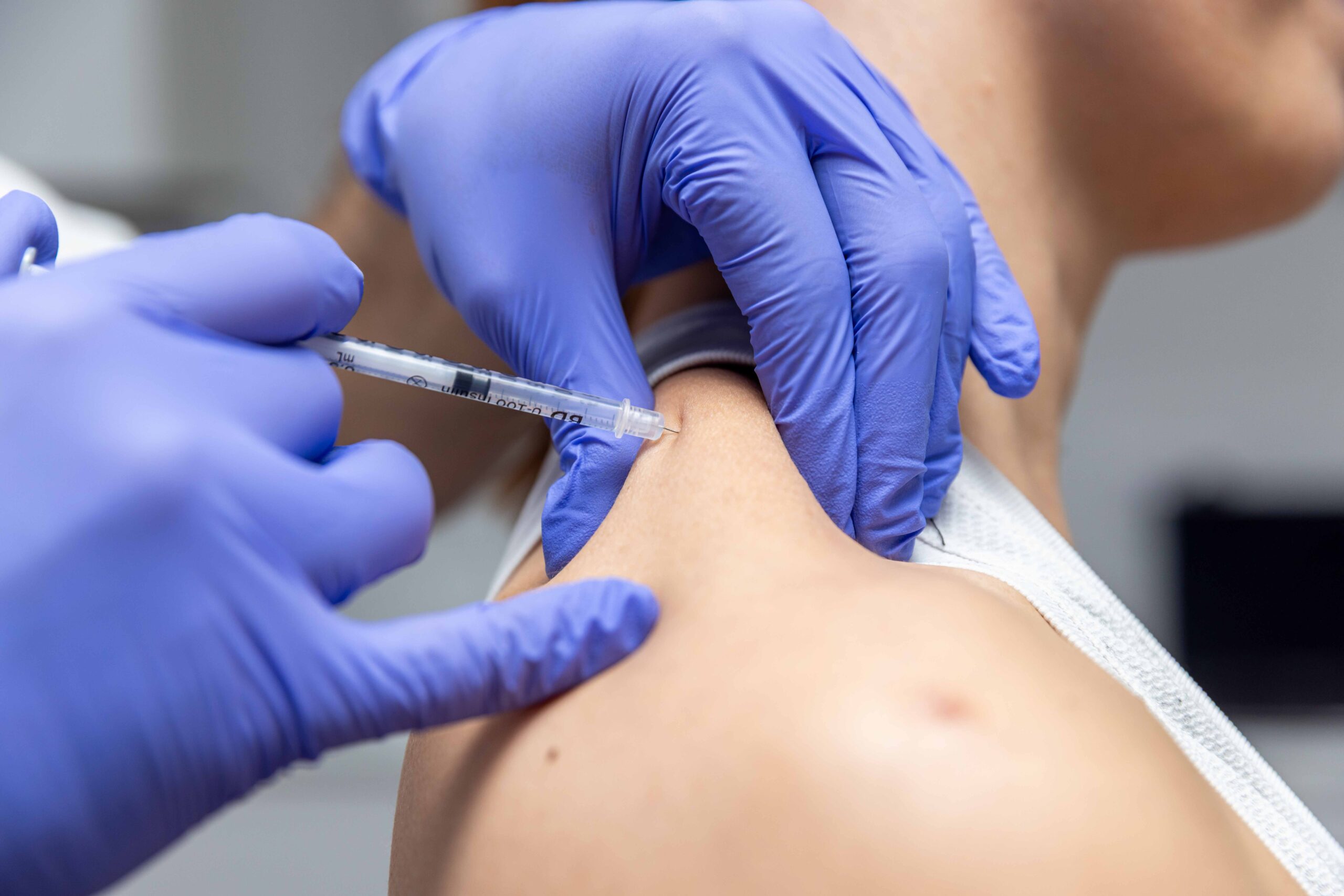 Botox for headaches